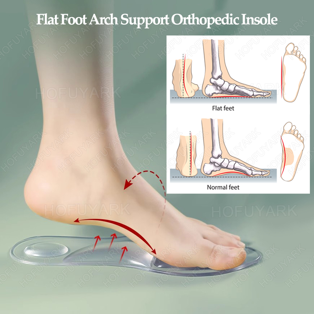 Semelles orthopédiques en gel  - Women'S Shoes High Arch Support avis et prix